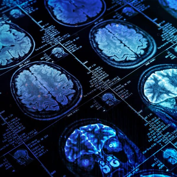 Mass General Turns to AI to Improve Medical Imaging Quality