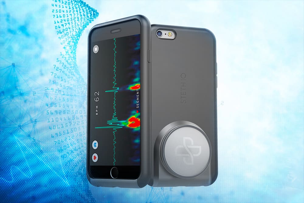 Steth IO is a Stethoscope in a Smartphone